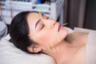 Acupuncture-For-Jaw-Pain-1536x1024